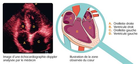 Échocardiographie cardiaque d'un cheval