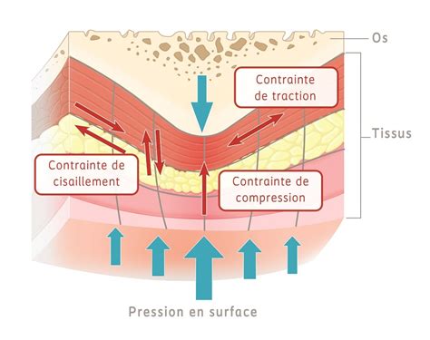 Illustration montrant la pression exercée sur le cou d'un chien