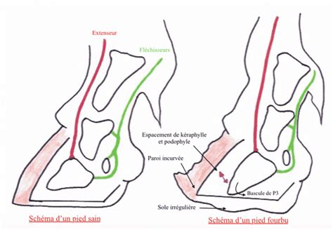 Schéma du basculement de la troisième phalange dans le sabot lors de fourbure