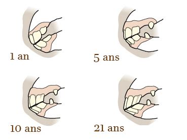 Schéma comparatif de la dentition d'un jeune cheval et d'un cheval âgé