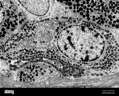 Micrographie électronique montrant l'organe de Haller sur le tarse d'une tique, sensible aux stimuli olfactifs et hygrométriques.