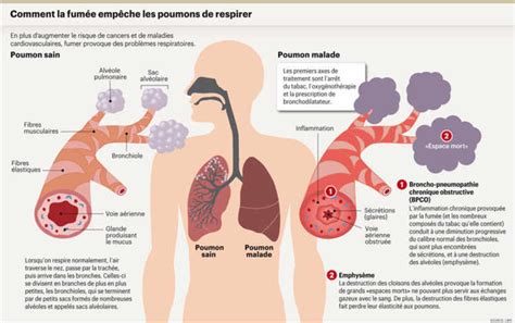 Schéma des effets du tabac sur les poumons
