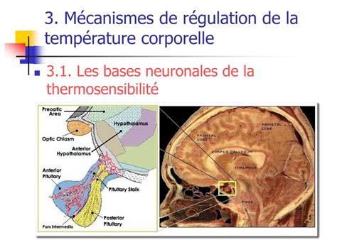 Schéma du centre thermorégulateur dans l'hypothalamus