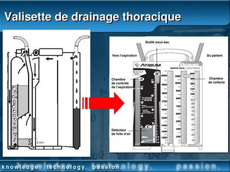 Schéma du drainage thoracique