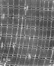 Microscopie électronique de fibres musculaires de cheval montrant une accumulation anormale de glycogène